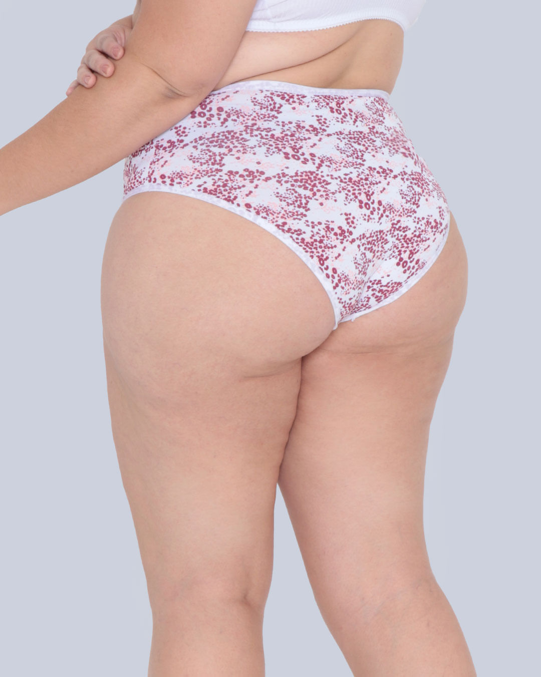 Kit-Tg9527cal-Alta-Cavada-Micro---Opcao-09