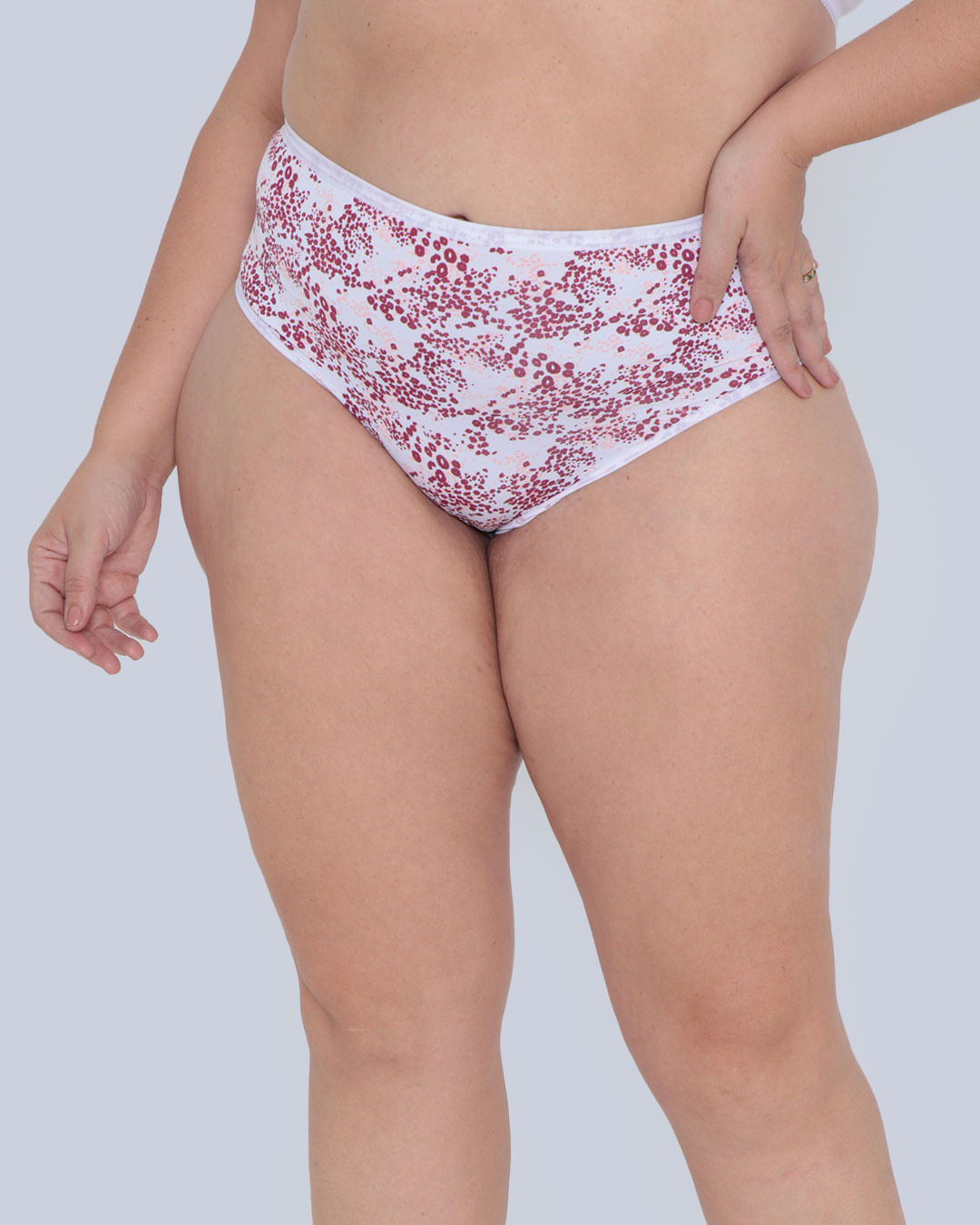 Kit-Tg9527cal-Alta-Cavada-Micro---Opcao-09